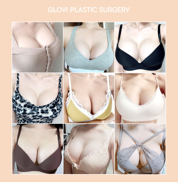 가슴확대수술전후, 보형물vs가슴지방이식 내게 맞는 방법은? 관련 이미지 2