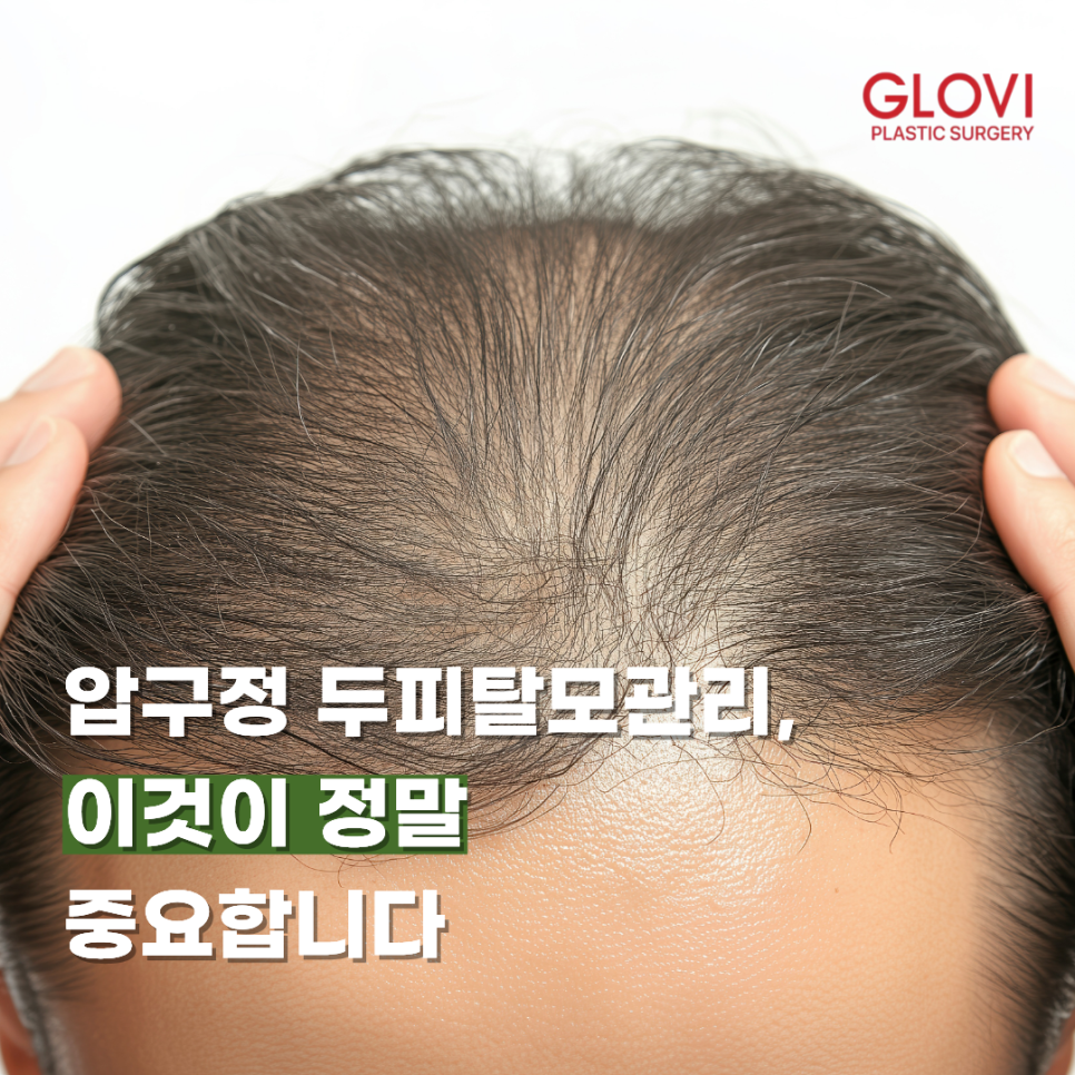 압구정 두피탈모관리, 이것이 정말 중요합니다. 관련 이미지 1