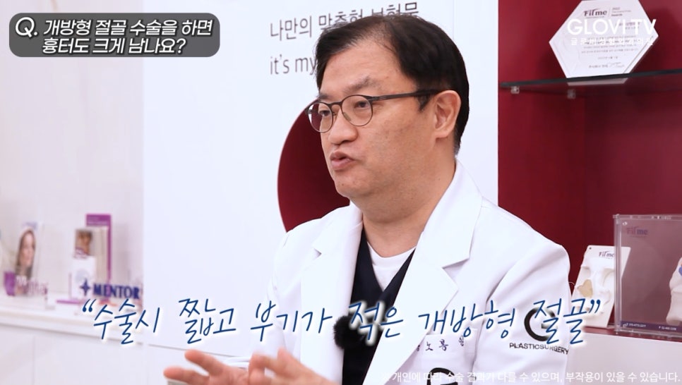 개방형 코 절골술, 흉터와 안전성은? 인터뷰 (3탄) 관련 이미지 7