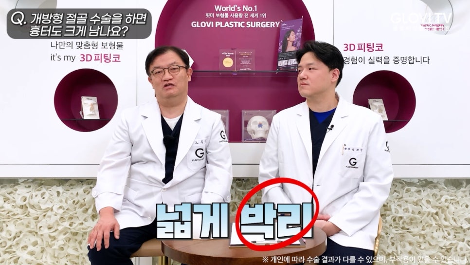 개방형 코 절골술, 흉터와 안전성은? 인터뷰 (3탄) 관련 이미지 4