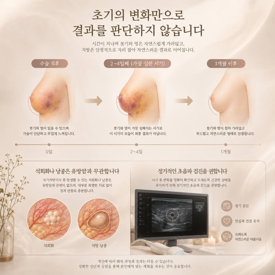 Reviews of Fat Transfer Breast Augmentation: It’s Not the Amount of Fat That Determines the Outcome image 9