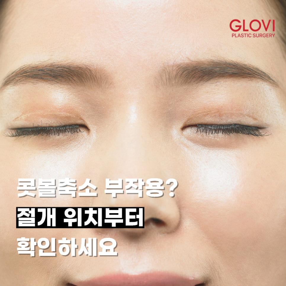 콧볼축소 부작용? 절개 위치부터 확인하세요 관련 이미지 1
