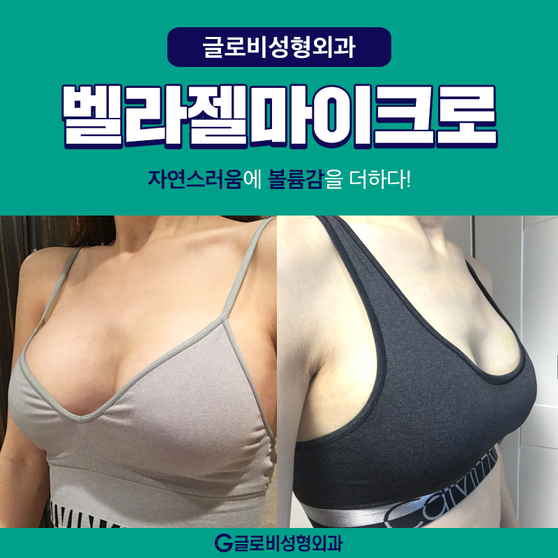 벨라젤가슴성형 움직임이 자연스러워요 관련 이미지 1