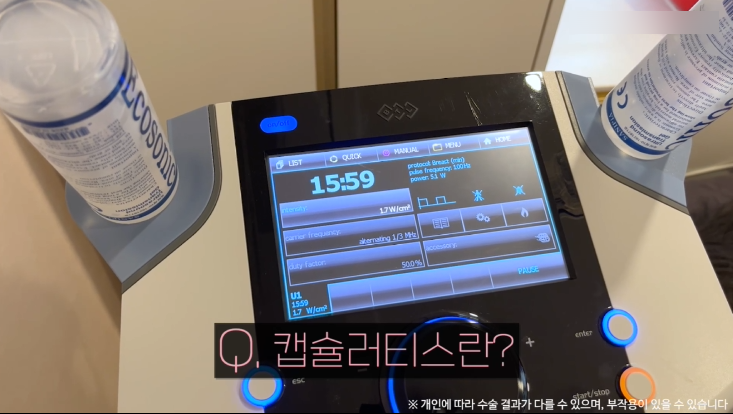 모티바가슴성형 리얼후기 2탄｜글로비성형외과의원 관련 이미지 15