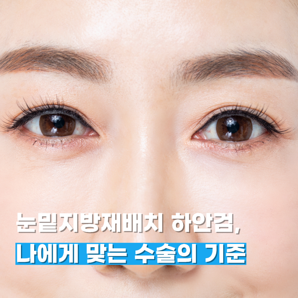 Lower Eyelid Fat Repositioning vs. Lower Blepharoplasty: Choosing the Right Surgery for You image 1