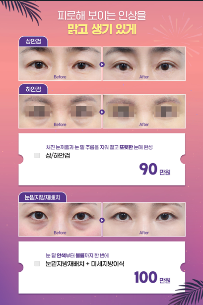 [글로비성형외과] August SUMMER FESTIVAL Event Roundup image 3