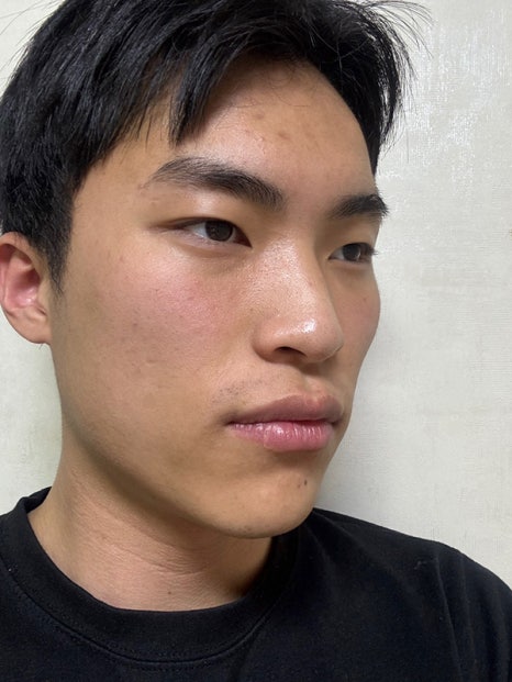 남자 코성형 여성과 확연히 다른 디자인 포인트 관련 이미지 2