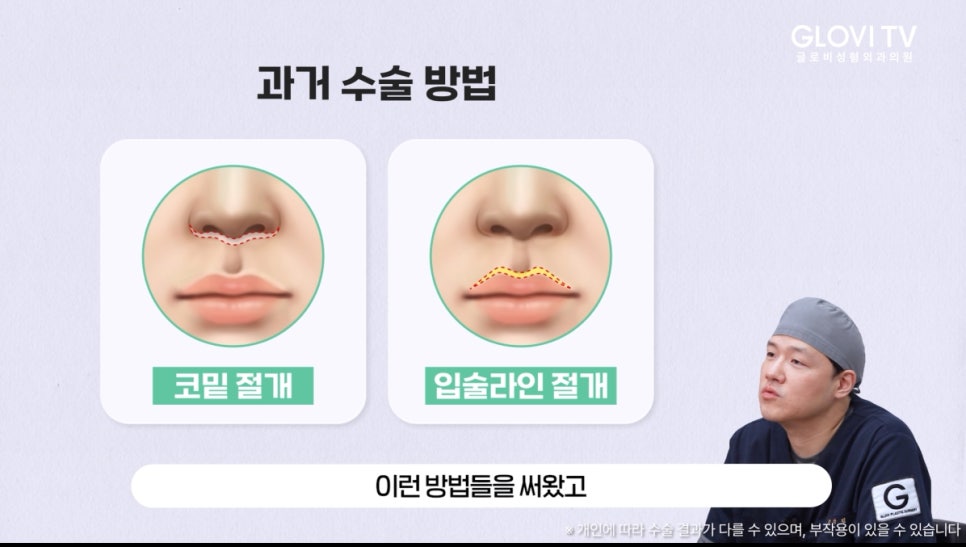 글로비성형외과의원 인중축소술 알아보기 관련 이미지 4