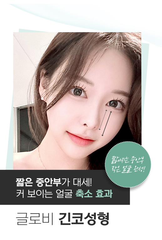 코성형 긴코, 어떻게 줄이고 자연스럽게 만들까? 관련 이미지 2