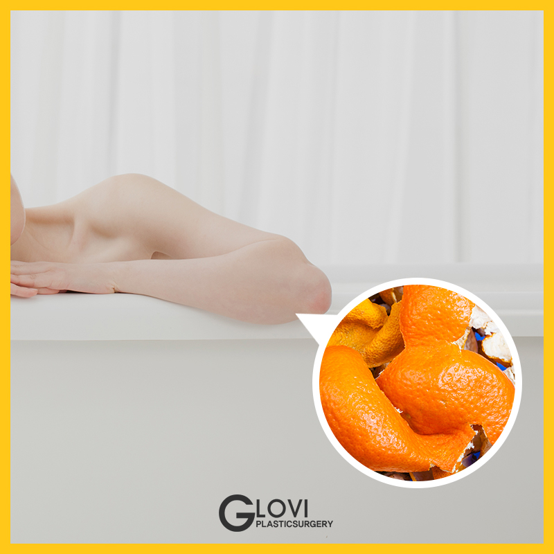 귤 껍질 활용법 이제 버리지 마세요! 관련 이미지 3