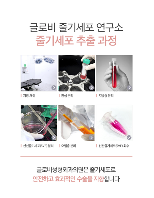 강남가슴성형, 지방이식전 알아둬야할 체크리스트 관련 이미지 9