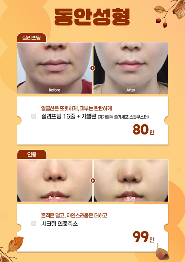 [글로비성형외과] 이번 가을, 나를 더 아름답게 9월 AUTUMN START 이벤트 총정리 관련 이미지 5