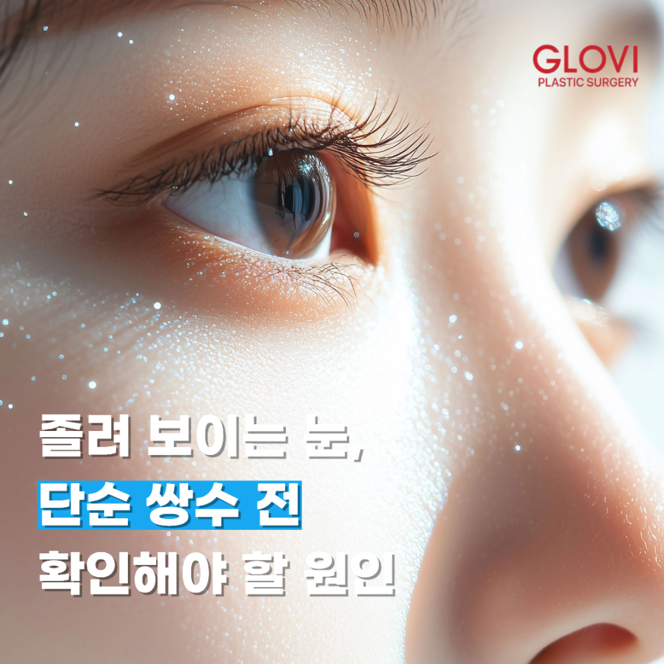 Sleepy-Looking Eyes: Causes to Check Before Simple Double-Eyelid Surgery image 1