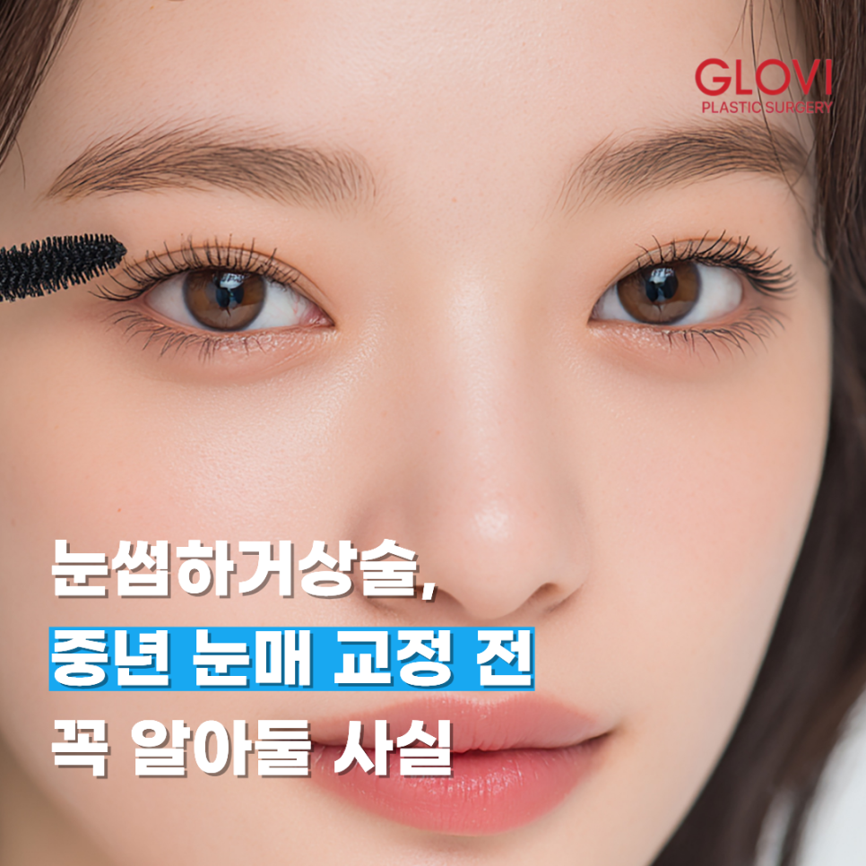 눈썹하거상술, 중년 눈매 교정 전 꼭 알아둘 사실 관련 이미지 1