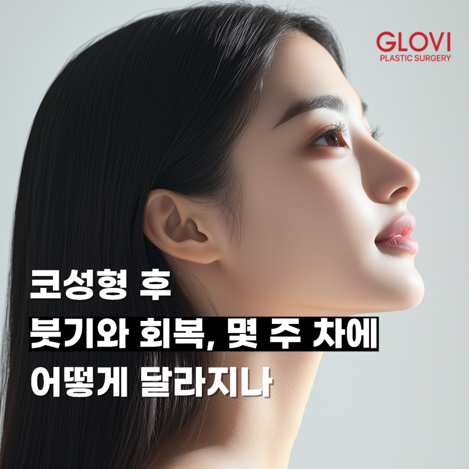 코성형 후 붓기와 회복, 몇 주 차에 어떻게 달라지나 관련 이미지 1