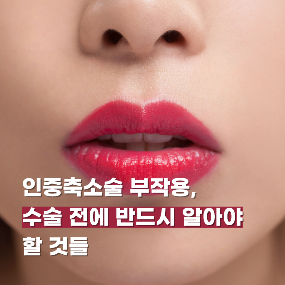 인중축소술 부작용, 수술 전에 반드시 알아야 할 것들 관련 이미지 1