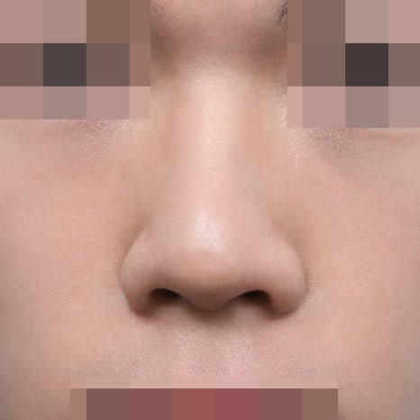 남자 코성형 여성과 확연히 다른 디자인 포인트 관련 이미지 5