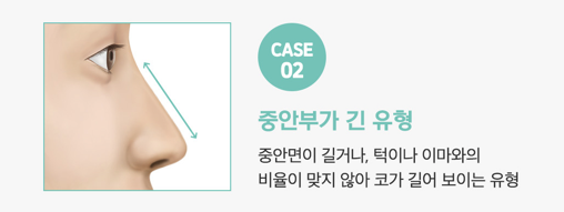 코성형 긴코, 어떻게 줄이고 자연스럽게 만들까? 관련 이미지 8