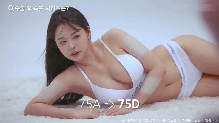 모티바가슴성형 리얼후기 2탄｜글로비성형외과의원 관련 이미지 21