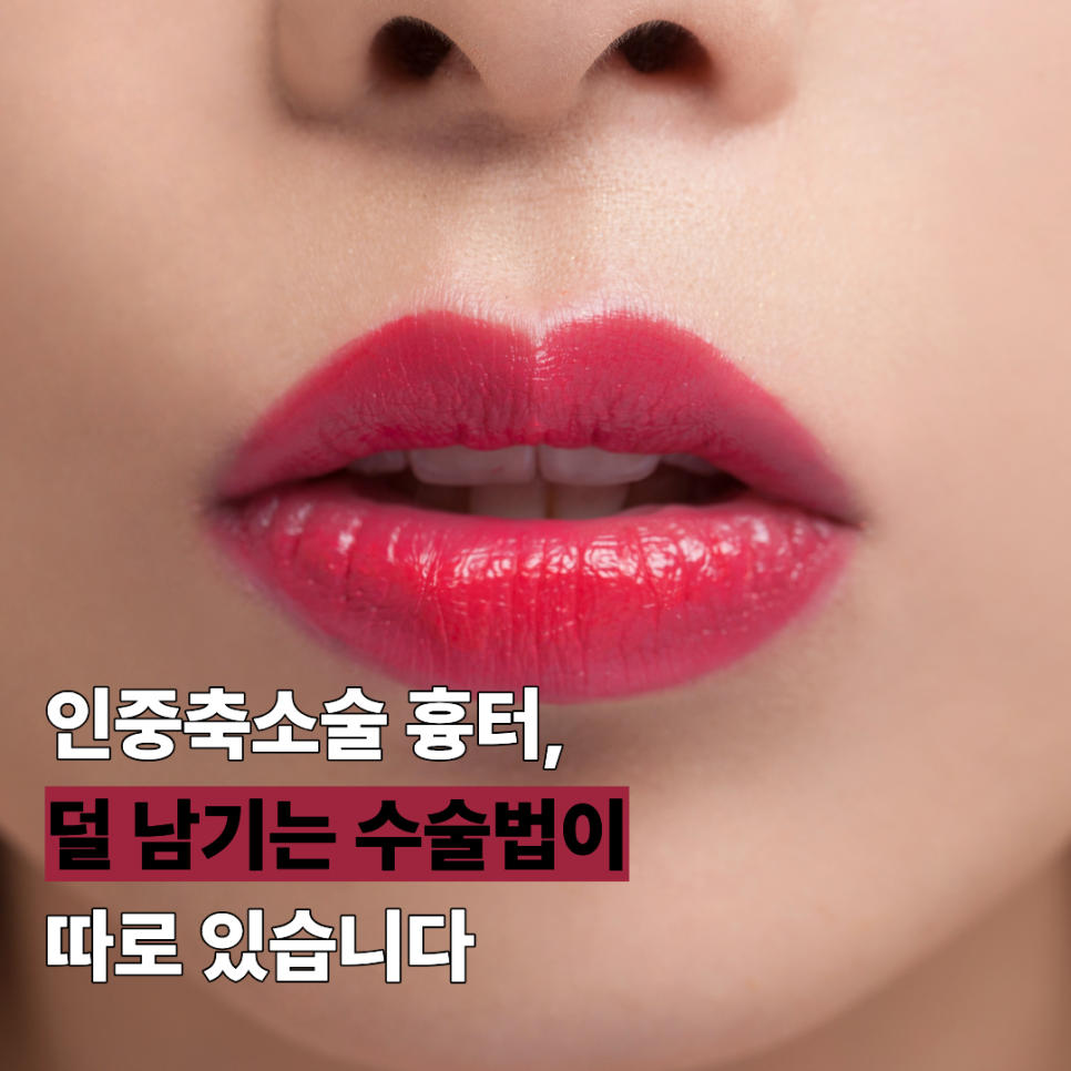 인중축소술 흉터, 덜 남기는 수술법이 따로 있습니다 관련 이미지 1