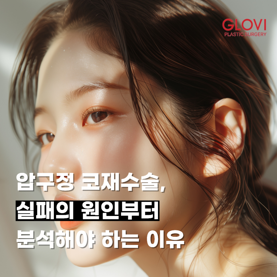 압구정 코재수술, 실패의 원인부터 분석해야 하는 이유 관련 이미지 1