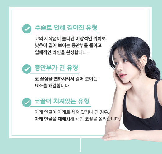 코성형 긴코, 어떻게 줄이고 자연스럽게 만들까? 관련 이미지 11