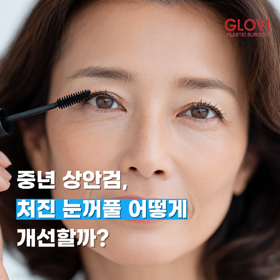 How Can Drooping Upper Eyelids Be Improved in Middle Age? image 1