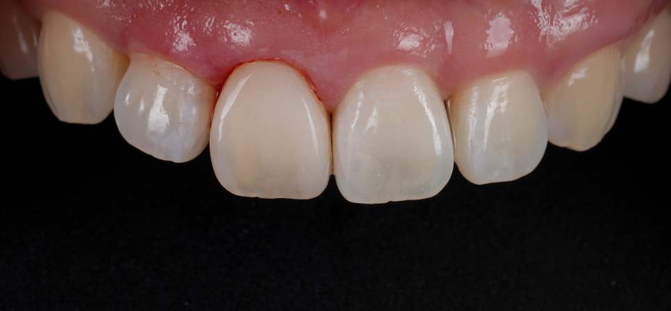 서초치과 5년간 14개 치과 돌다 본원에서 정착한 이유는? 관련 이미지 11