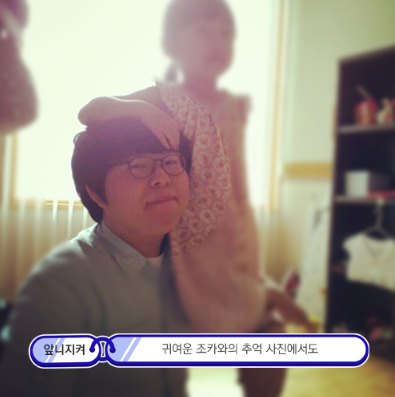 앞니 벌어짐 레진으로 삭제없이 충분히 예쁘게 할 수 있어요 관련 이미지 9