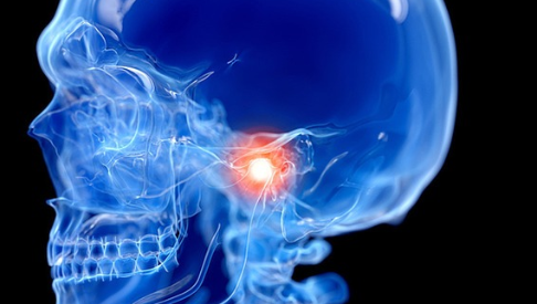 이갈이 보톡스 맞아도 효과 없던 결정적 이유 알려드려요 관련 이미지 6