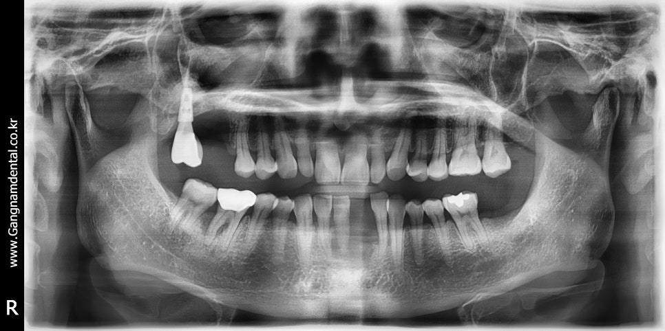 20년11월29일 / 김영삼원장님 라이브서저리 4회차 관련 이미지 1