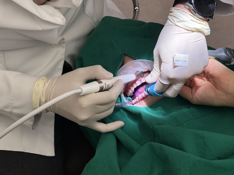 스케일링 시린 통증으로 불편한 치아, 교대역 파우더 스케일링으로 해결 관련 이미지 2