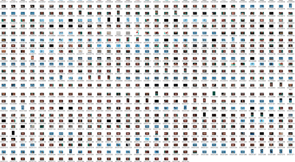 소현수 원장이 앞니 치료를 공부하는 이유 관련 이미지 14