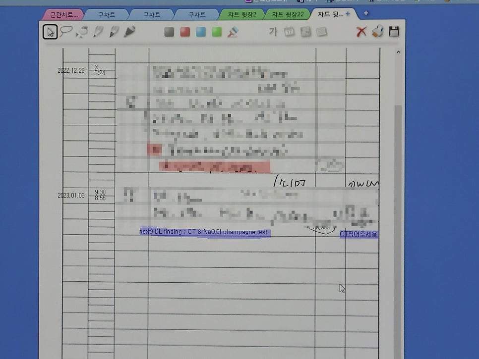 신경치료 잘하는 치과의사가 되자 : 근관 찾기 관련 이미지 5
