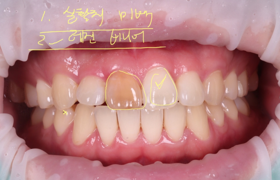 서초치과 5년간 14개 치과 돌다 본원에서 정착한 이유는? 관련 이미지 6