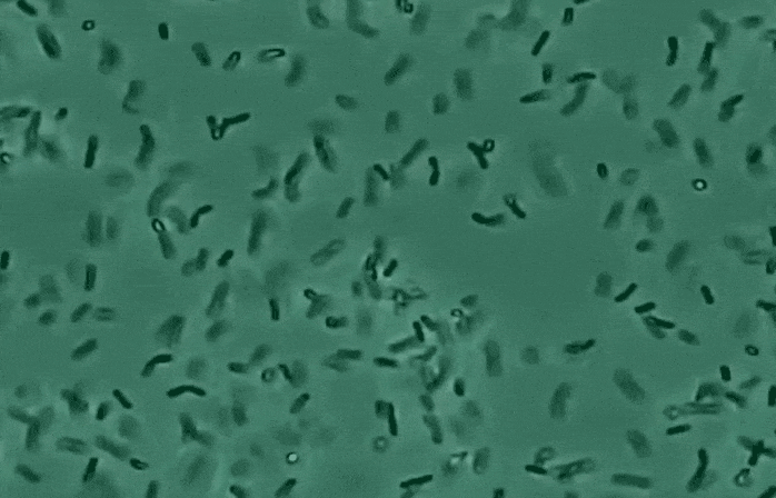 교대역치과 러버댐을 쓰는 곳을 찾아야 하는 이유 관련 이미지 5