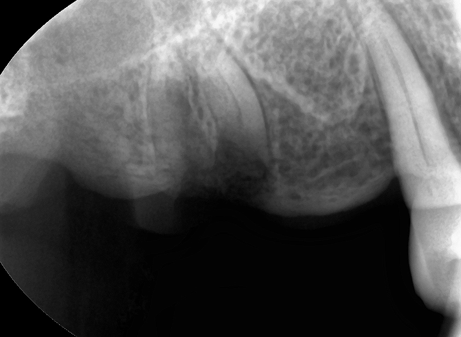 치과 페닥 4개월 근무 후기 (short ver.) 관련 이미지 2