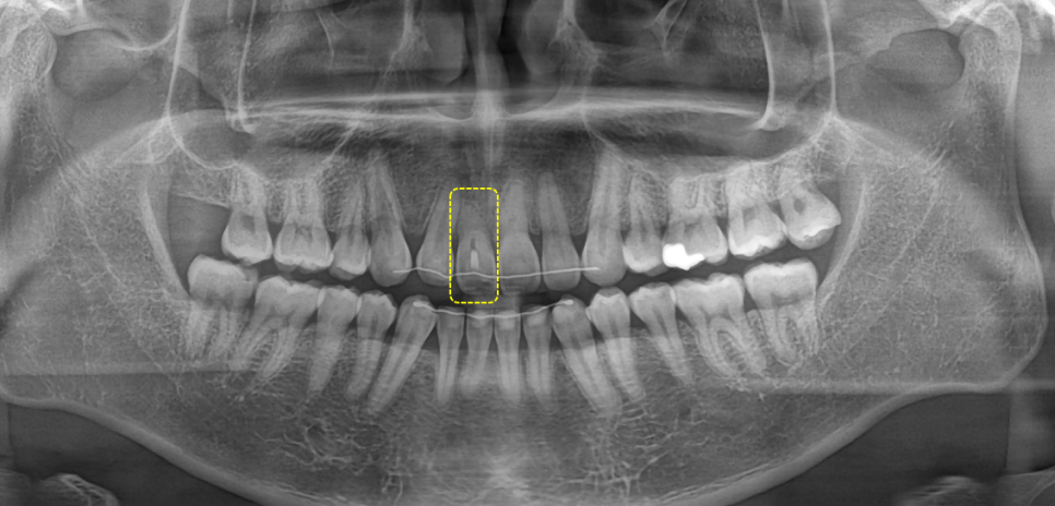 서초치과 5년간 14개 치과 돌다 본원에서 정착한 이유는? 관련 이미지 3