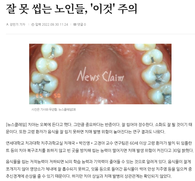 앞니 크라운 재치료 시니어에게 더 중요한 이유 관련 이미지 5