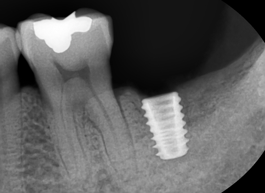 20년11월29일 / 김영삼원장님 라이브서저리 4회차 관련 이미지 2
