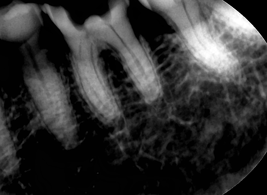 15주차 페닥 일기, 굳은살 관련 이미지 6