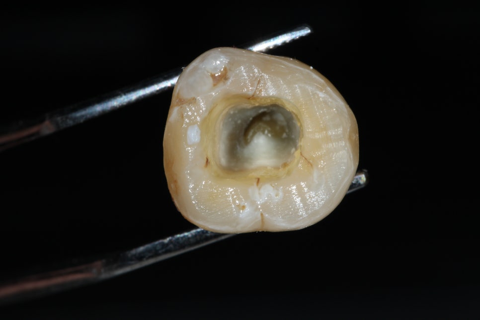 22년5월22일 / Troubleshooting Symposium, 조용식원장님 AO intensive course 관련 이미지 5
