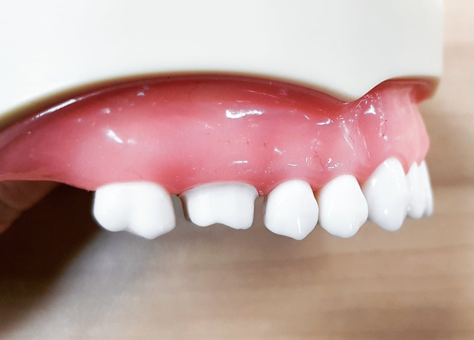 치과 공보의 일기 (31) : 모르면 용감 관련 이미지 3