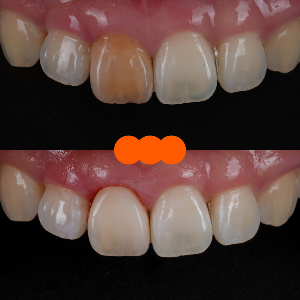 서초치과 5년간 14개 치과 돌다 본원에서 정착한 이유는? 관련 이미지 13
