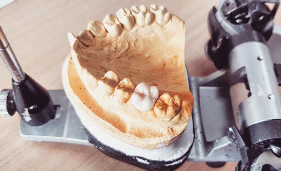 치과 공보의 일기 (31) : 모르면 용감 관련 이미지 2