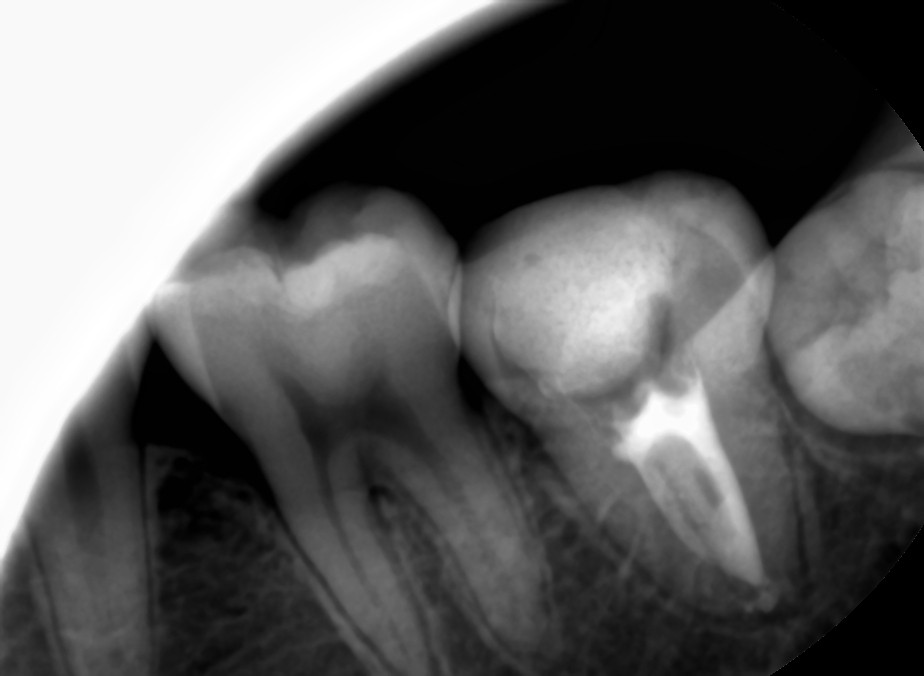 치과 페이닥터 3개월째 근무 일기 long ver. 관련 이미지 9