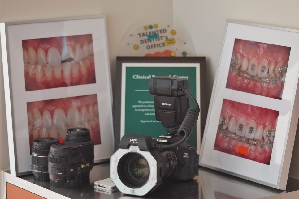 서울치과 앞니 레진 전 이걸 먼저 확인해야 돼요 관련 이미지 11