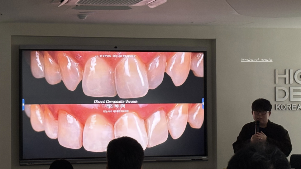 소현수 원장 앞니 레진 빌드업 세미나 강의 관련 이미지 4