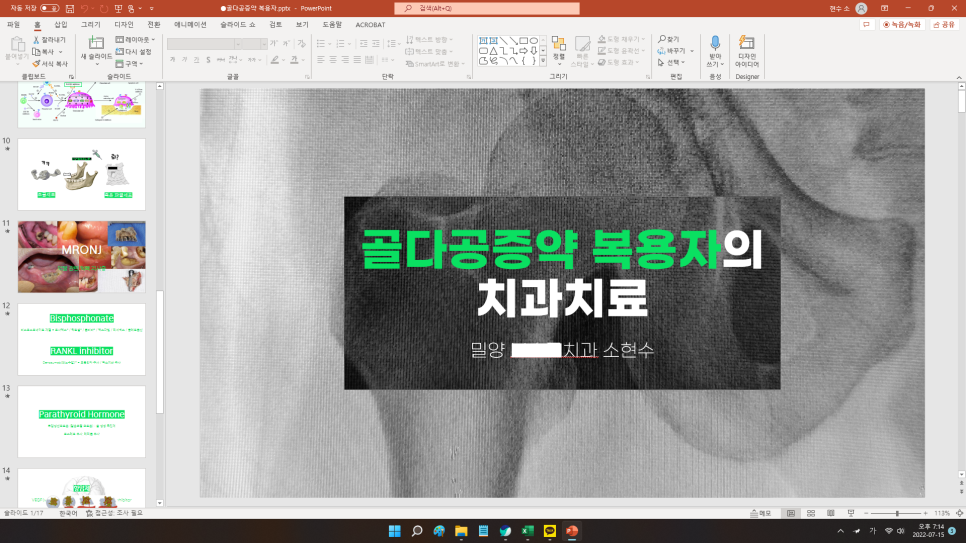 치과 페닥 14주차 주간일기 관련 이미지 1