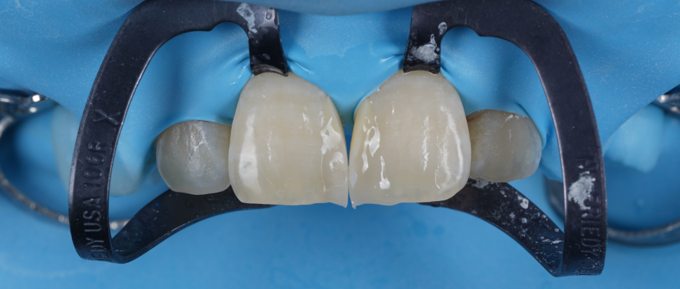 양재역치과 앞니 레진 받으러 수원에서 오신 이유(feat. 치과의사 소개) 관련 이미지 8